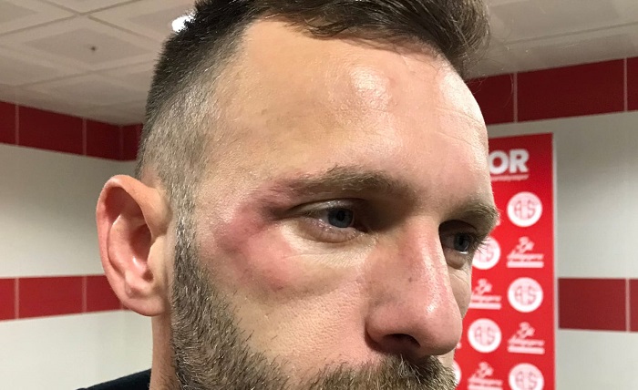 Hakan Özmert’ten VAR Tepkisi